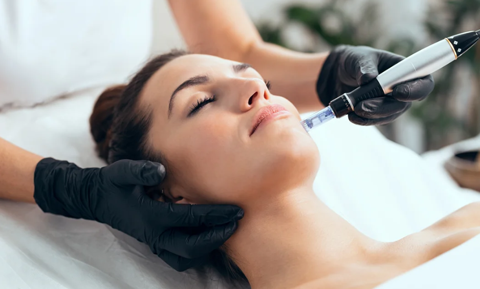 Precision in Skin Care: Elevating Your Expertise with the Microneedling Course by Glow Beauty